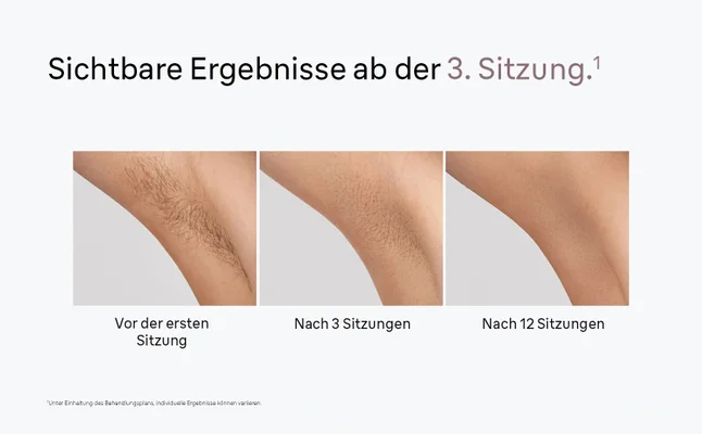 Der geteilte Bildschirm zeigt Aufnahmen der Achsel vor und nach der Behandlung mit reduziertem Haar.